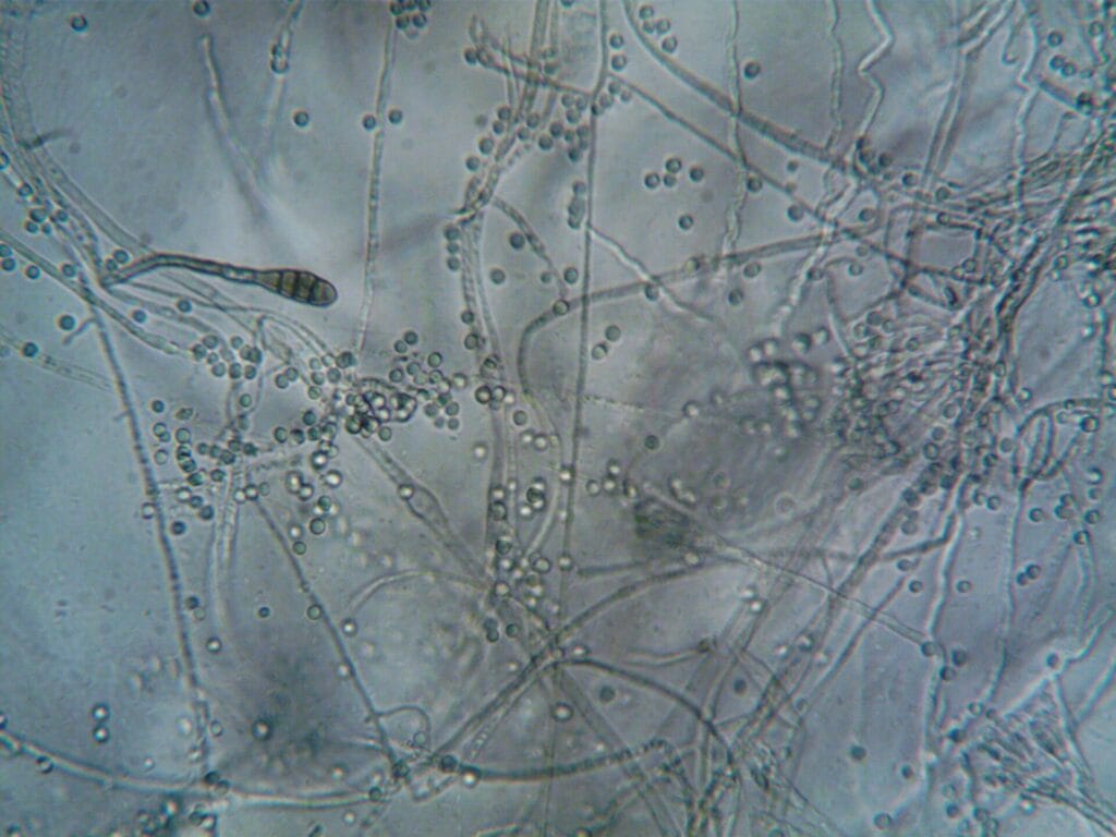 Detailed microscopic view showing fungal hyphae and spores, ideal for biology and microbiology themes.